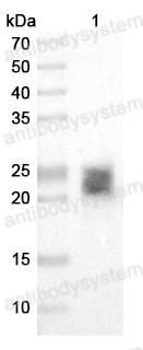 Mouse Anti-Monkeypox virus/MPXV M1R Antibody (SAA0284)